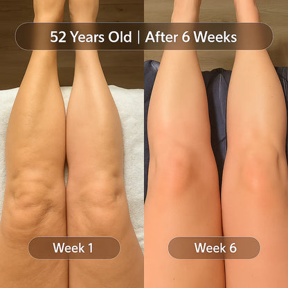 Anti-Cellulite Massage Oil